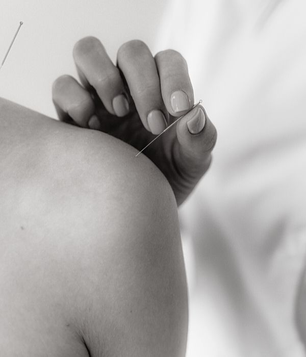 sportsakupunktur m-massage